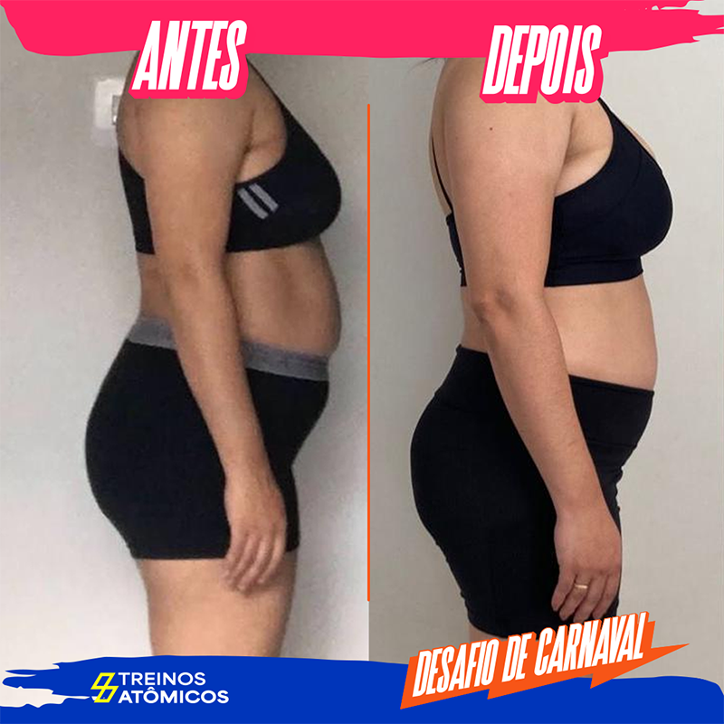 antes e depois3